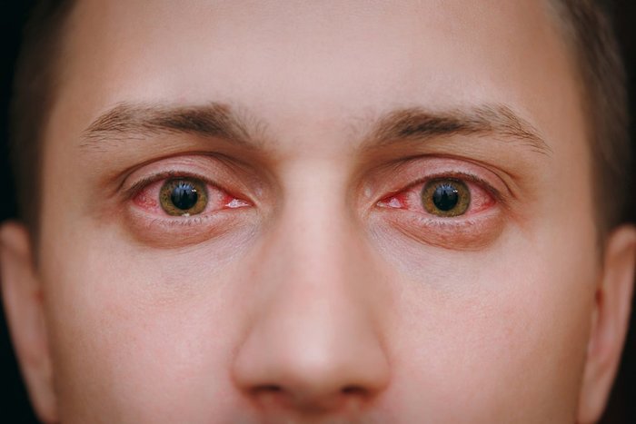 how long does weed make your eyes red