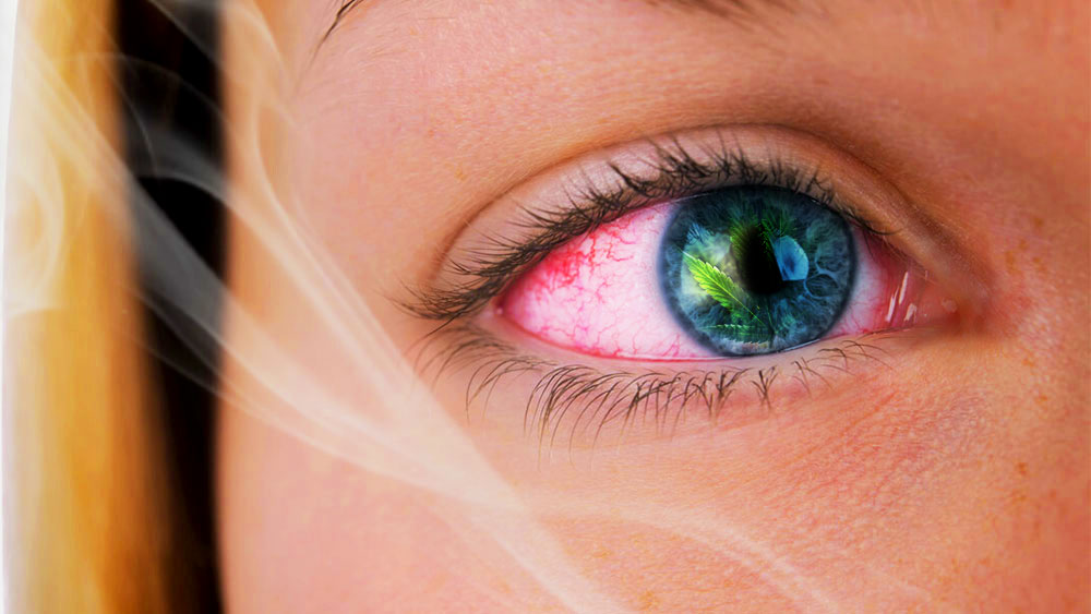 how long does weed make your eyes red