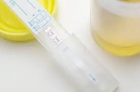 marijuana urine test